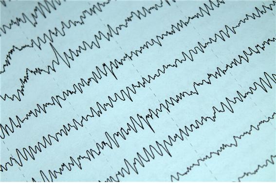 손떨림...무시하지마세요!! 파킨슨병에 대해서...
