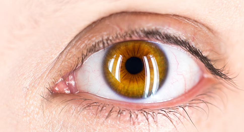 안구건조증 증상