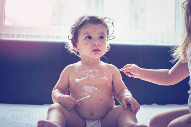 가와사키병 증상 및 원인&amp;#44; 치료와 예방방법을 알아봤습니다. 가와사키병은 아이가 갑자기 이유 없이 고열에 시달리면서 시작되는 질병입니다. 어떤 질환인지 꼼꼼히 읽어 보시기 바랍니다. 