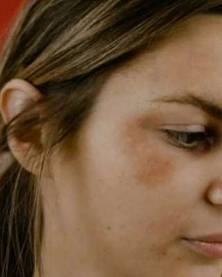 멍이 잘 드는 이유와 오래가는 이유&amp;#44; 병일까?