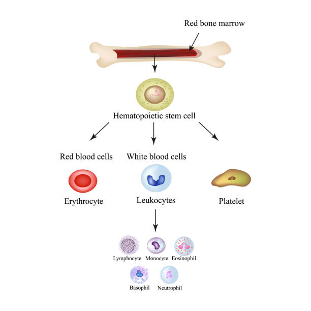 골수증식성 질환 증상