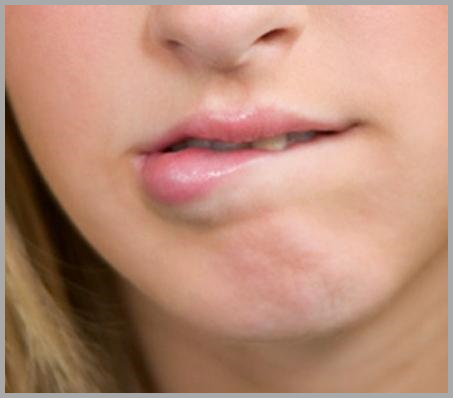 입안 피멍울 원인 치료방법