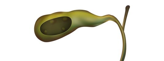 담낭선근종