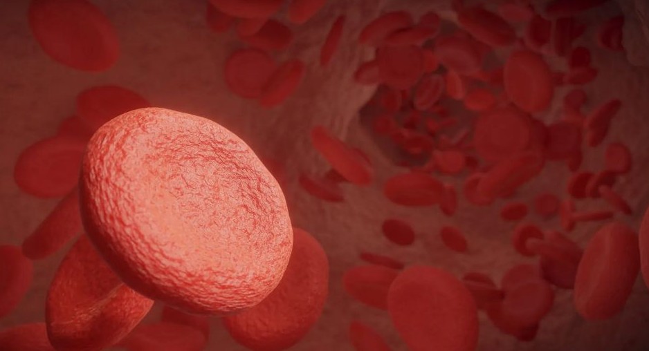 경동맥 협착증 치료