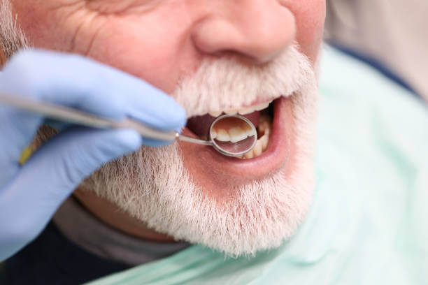 [이가탄] 효능, 복용법, 부작용 (잇몸 약/영양제 추천)