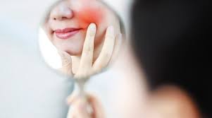 얼굴이 붉어지는 증상