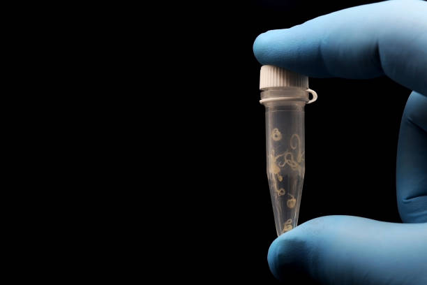 기생충 감염 검사 방법