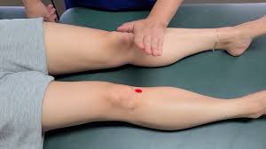 오금이 아픈 이유