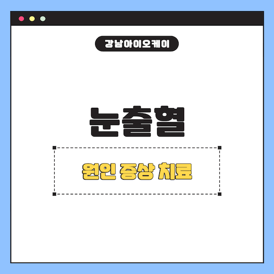 눈출혈-원인-증상-치료