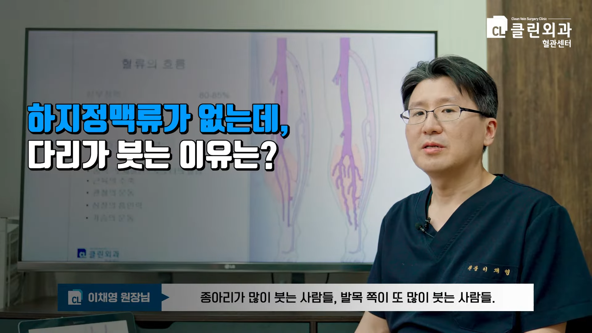 다리 부종이 발생하는 이유