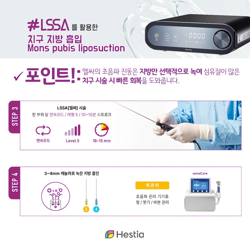 엘싸를 활용한 치구지방흡입 포인트