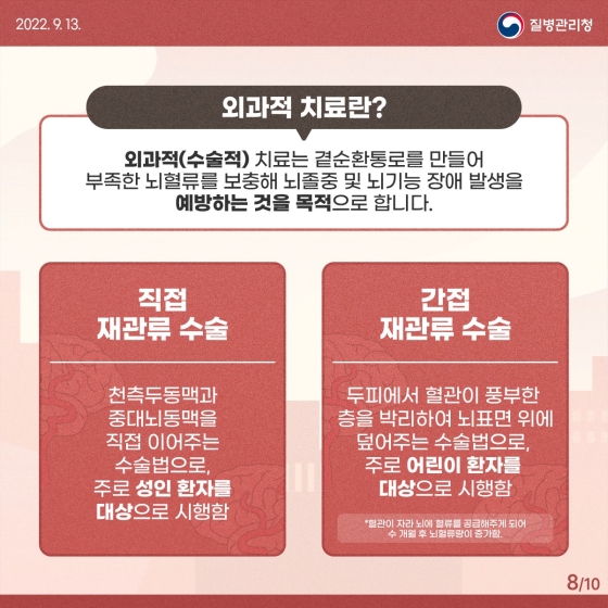 모야모야병 치료 방법