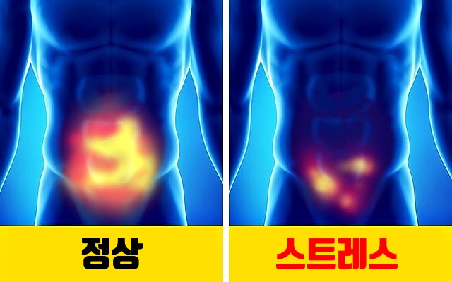 심한 스트레스 증상, 성욕이 떨어짐, 건강 팁줌 매일꿀정보