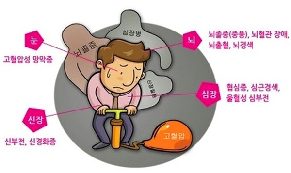 혈압 낮추는 법 정상수치 혈압 높을때 증상