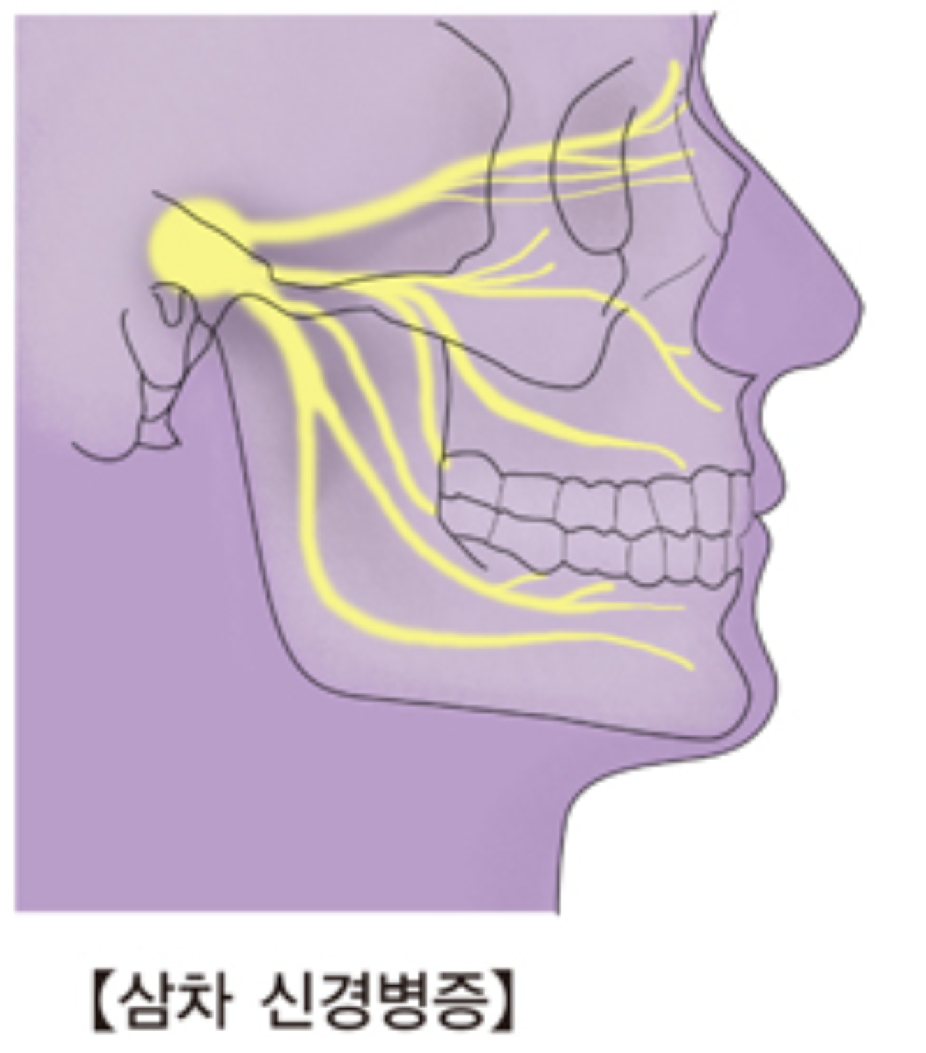 삼차신경 이미지