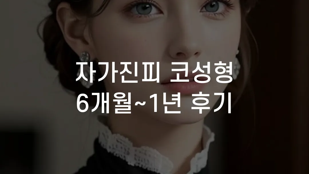 자가진피 코성형 6개월~1년 후기