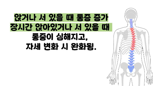 추간판 탈출증 증상