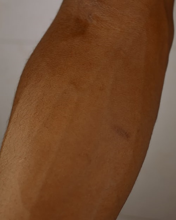 콘드로이친 효능