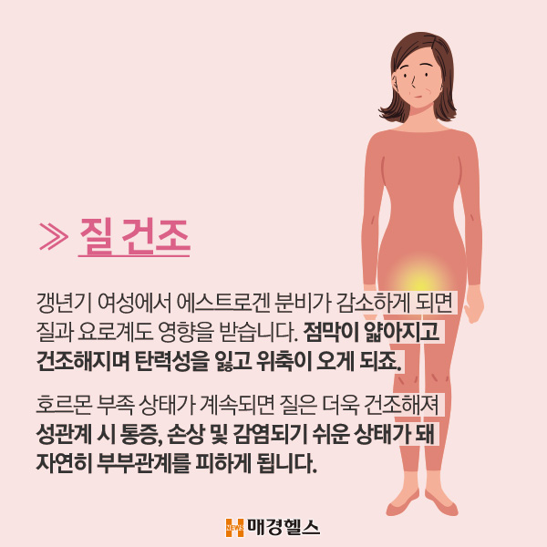 여성 갱년기 대표적인 증상5