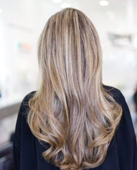 모발이식 3000모 비용