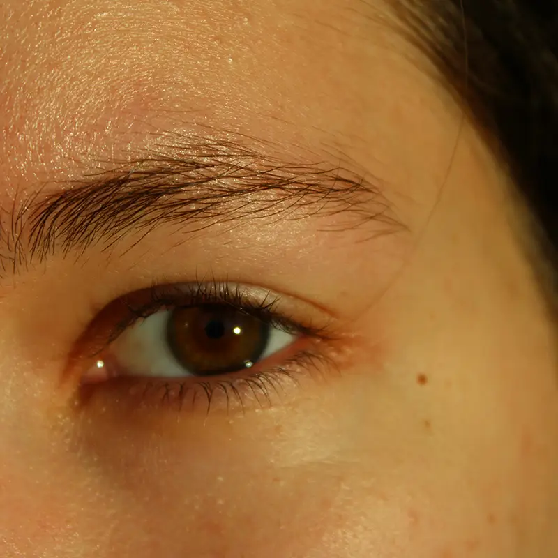 중년 여성 피부장벽 무너질 때 생기는 기미·잡티, 이렇게 회복하세요