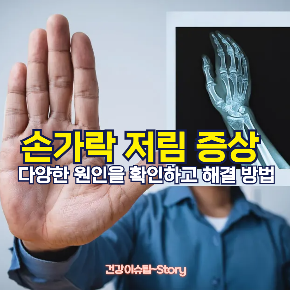 손가락 저림 증상, 방치하면 안 되는 이유