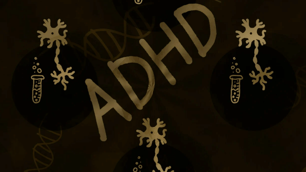 ADHD 이미지