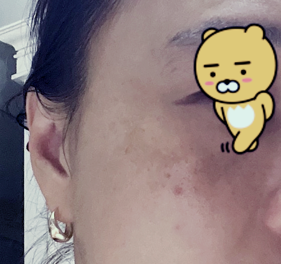 사용전 광대기미