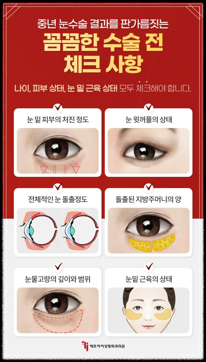 중년의 눈처짐&amp;#44; 쌍꺼풀 수술로 해결할 수 있을까요?