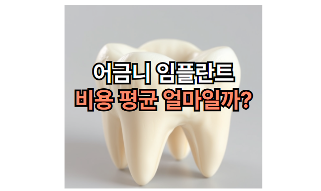 어금니-임플란트-비용-가격