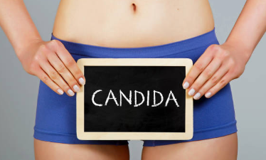 칸디다 질염 증상