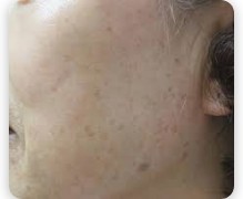 ๊ธฐ๋ฏธ ์์ ๋ ๋ฐฉ๋ฒ