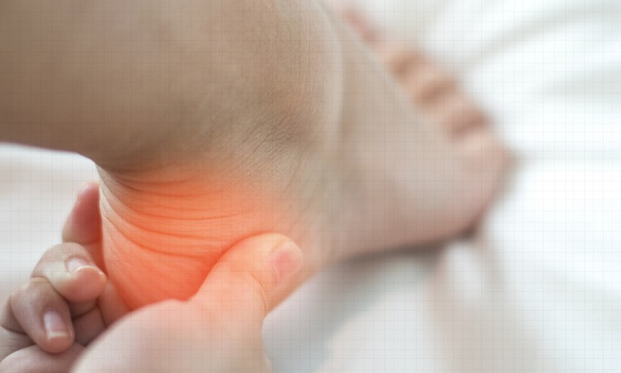 족저근막염 증상