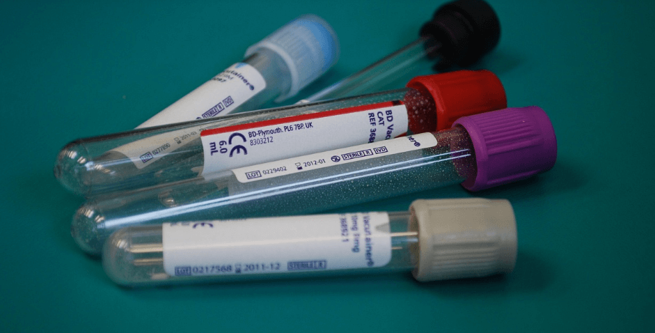 혈액 검사와 관련 된 사진들 - 5