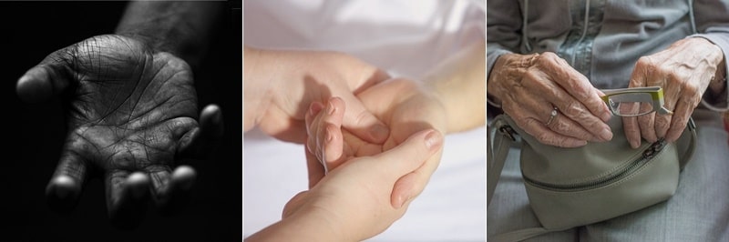 손가락 관절염 증상