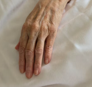 황반변성 증상 원인 치료법