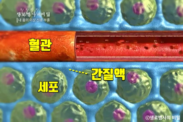 종아리 얼굴 붓는 이유, 붓기 부기 부종 원인 증상, 생로병사의 비밀, 다이어트 건강, 팁줌 매일꿀정보