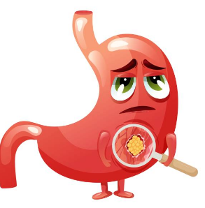 위암 초기증상, 수술비용, 수술후 회복기간 총정리 (2024ver)