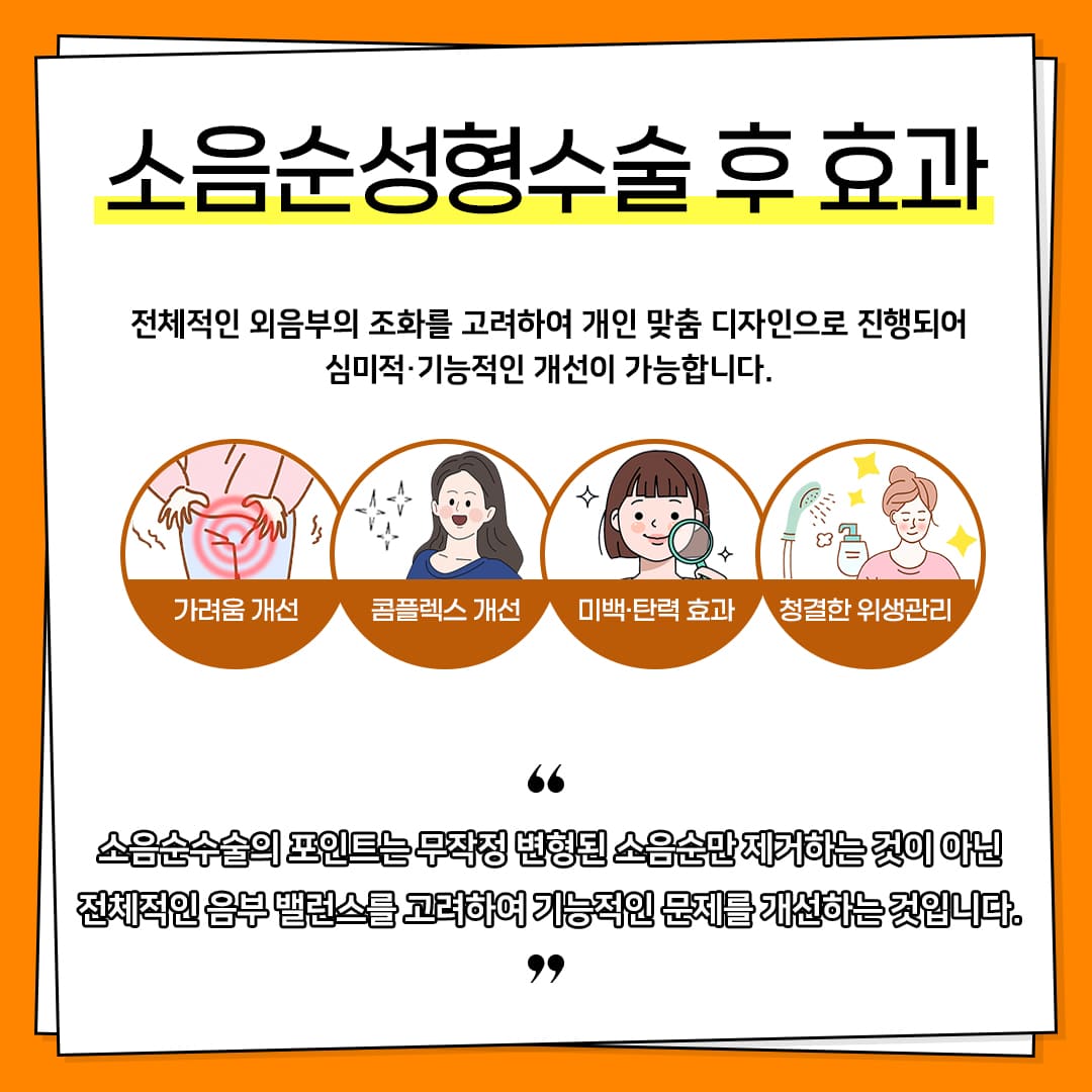 소음순성형수술 후 어떤 점이 좋나요?