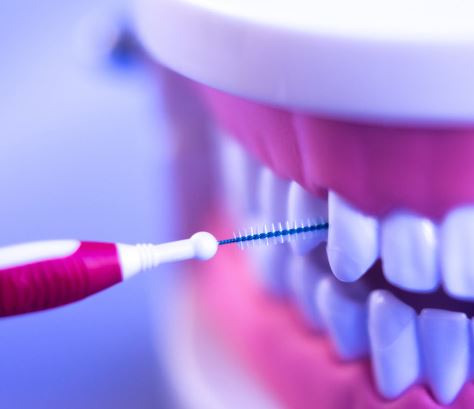 치간칫솔 사용법