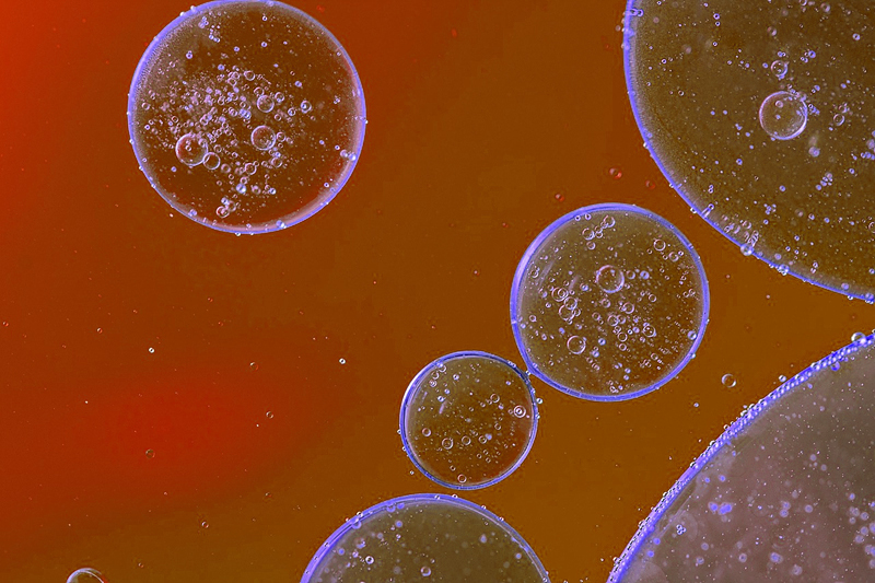 고지혈증 자가 체크리스트
