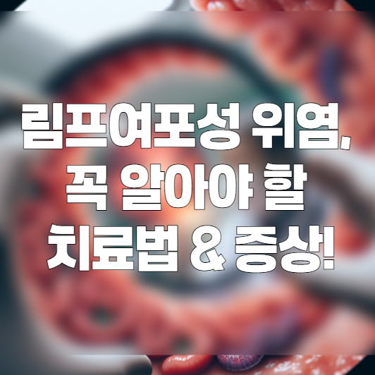 림프여포성 위염이란? 위암과의 관계 및 예방법 한눈에 보기