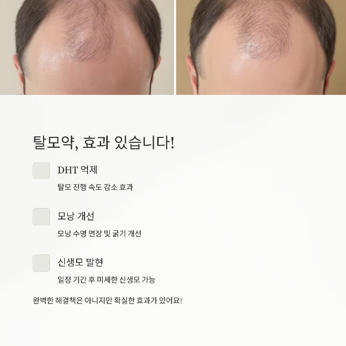 탈모약, 진짜 효과 있나요?