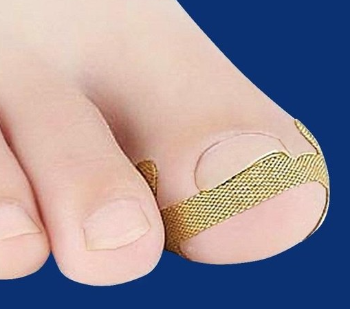 내성발톱 보호밴드