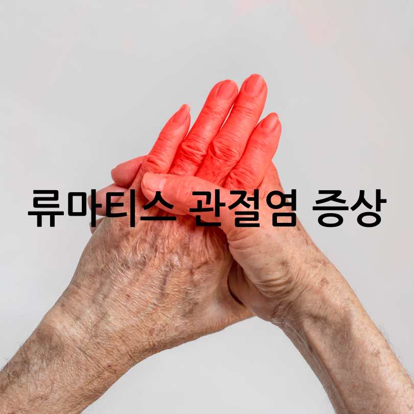 류마티스관절염 증상,식단,운동법