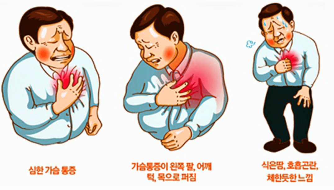 협심증 증상