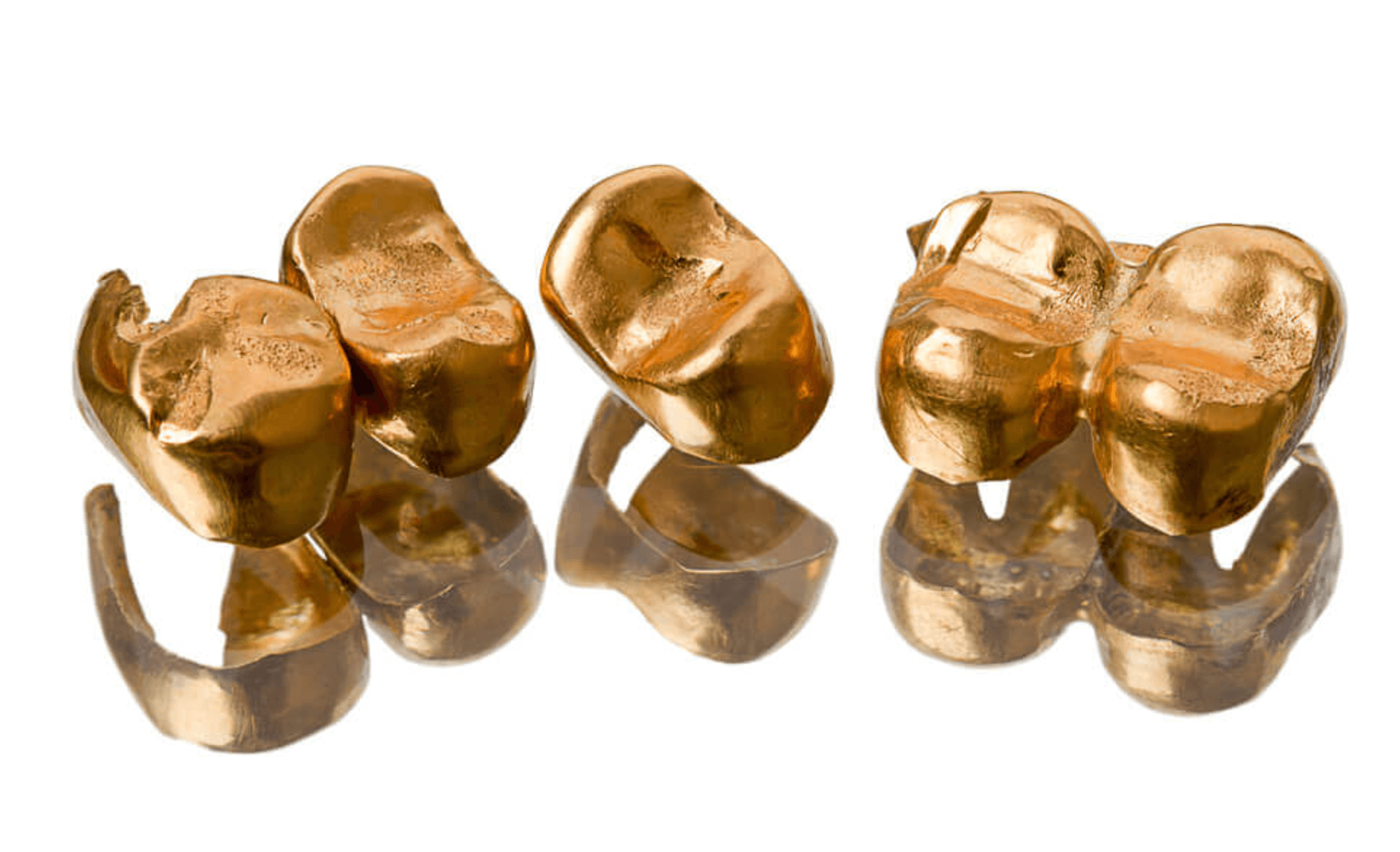 어금니 크라운 가격