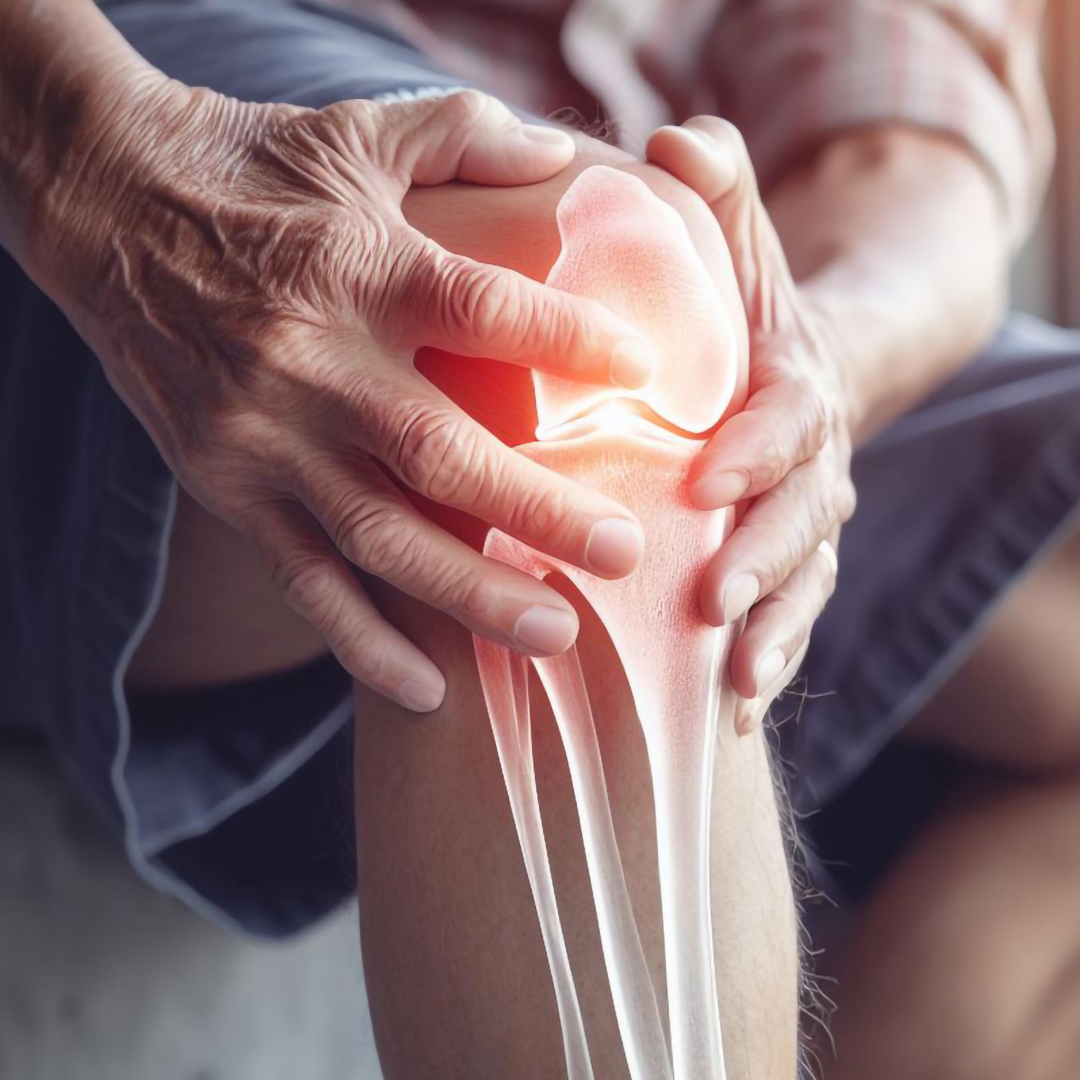 뼈와 관절 건강 관련된 사진