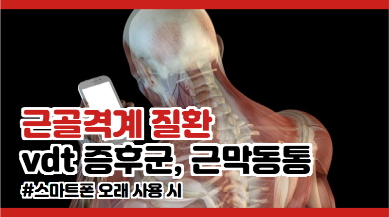 근육통