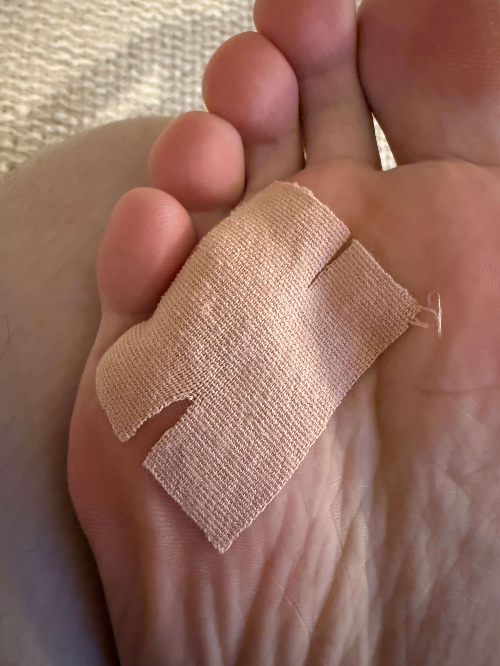 스포츠테이프-부착-사진